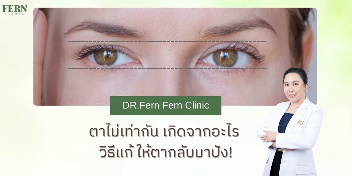 ตาไม่เท่ากัน มีวิธีแก้อย่างไรให้ตากลับมาปัง!