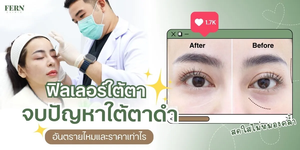 ฟิลเลอร์ใต้ตา จบปัญหาใต้ตาดำ อันตรายไหม ราคาเท่าไร