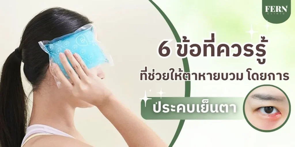 ประคบเย็นตา ดีอย่างไร 6 ข้อที่ควรรู้ ที่ช่วยให้ตาหายบวม