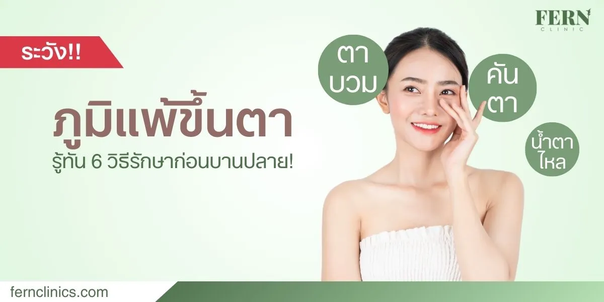 อาการ ภูมิแพ้ขึ้นตา รู้ทัน 6 วิธีรักษาก่อนบานปลาย