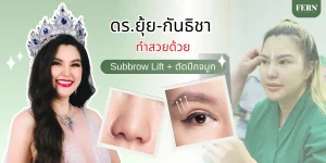 คุณยุ้ย กันธิชา มาทำSubbrow liftและตัดปีกจมูก