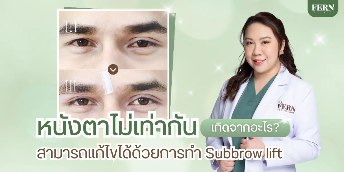 ตาไม่เท่ากัน เกิดจากอะไร? รวมสาเหตุและวิธีแก้ไขให้ตาเท่ากัน