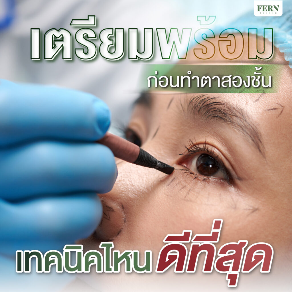 เตรียมพร้อมก่อนทำตาสองชั้น เทคนิคไหนดีที่สุด