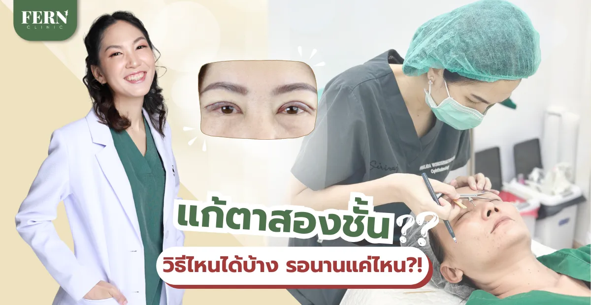 แก้ตาสองชั้น วิธีไหนได้บ้าง รอนานแค่ไหนกว่าจะแก้ได้