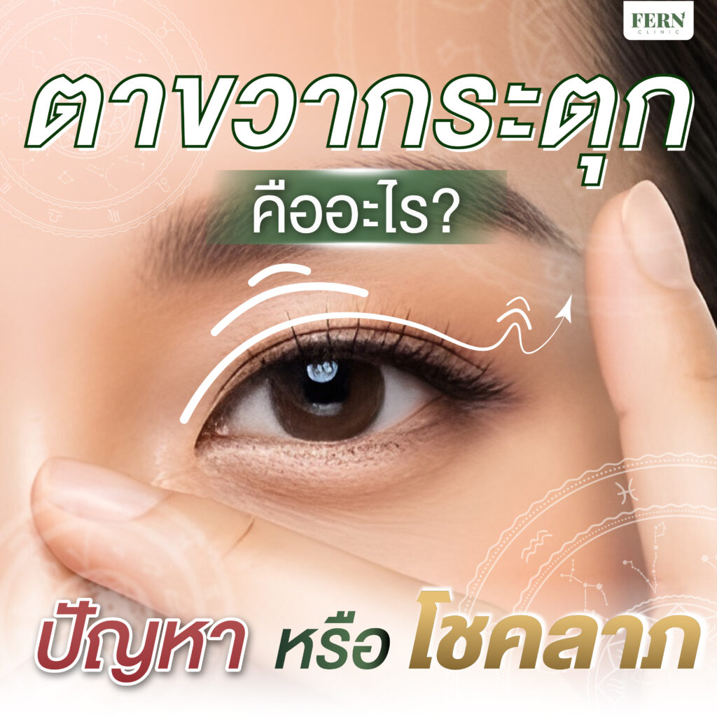 ตาขวากระตุก บอกอะไร ปัญหาหรือโชคลาภ