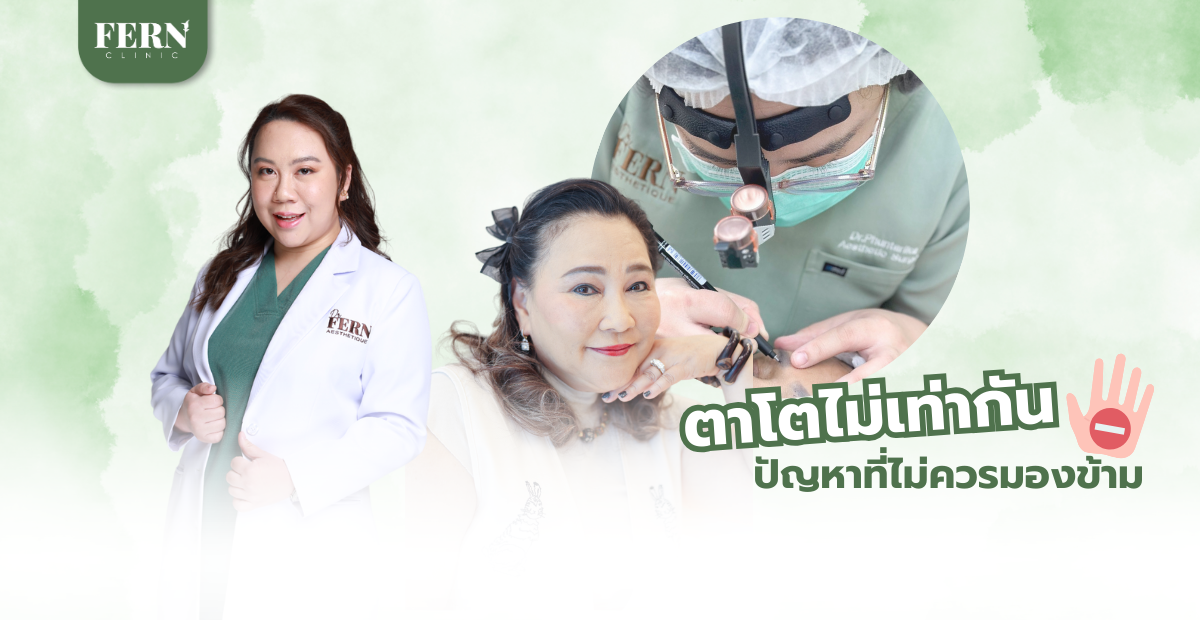 ตาโตไม่เท่ากัน ปัญหาที่ไม่ควรมองข้าม
