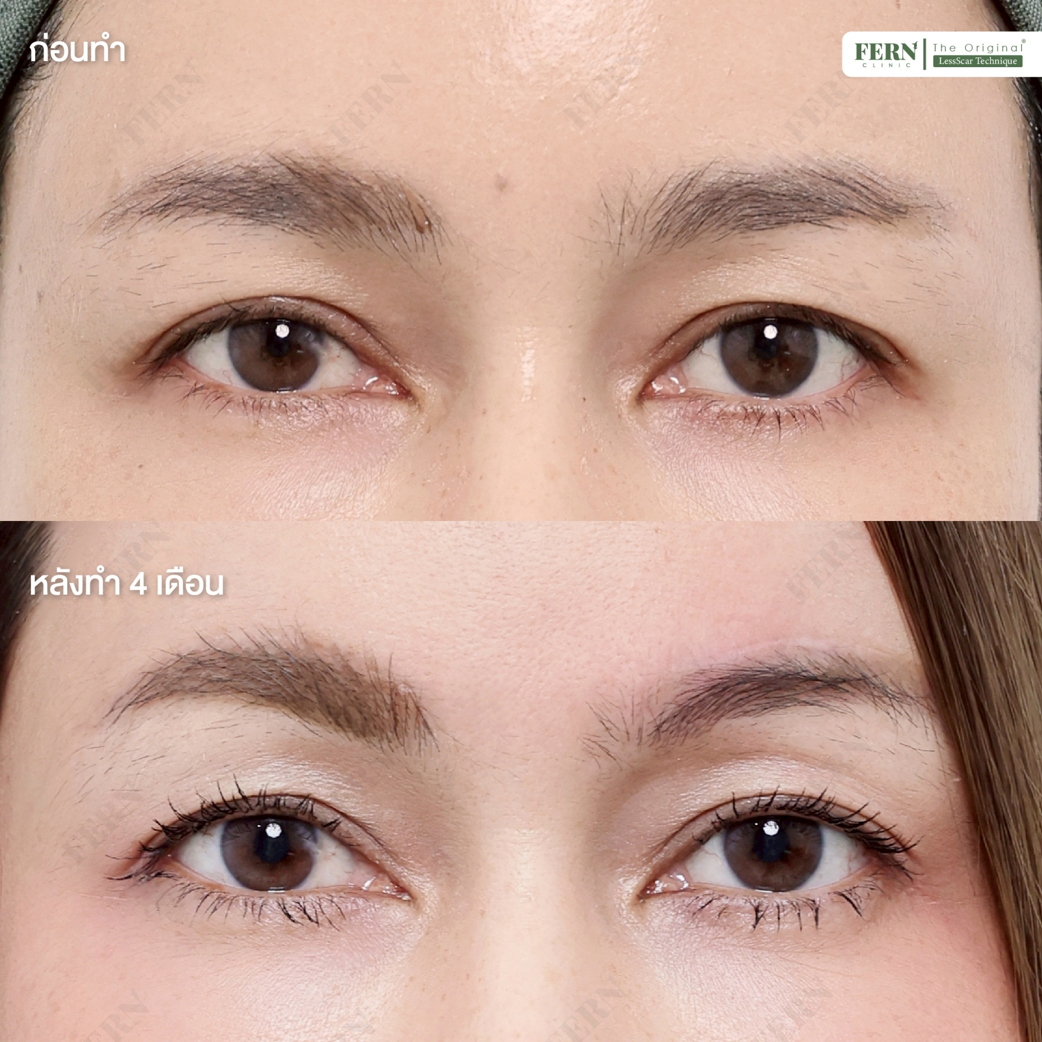 LINE_ALBUM_เคสรีวิว DBL_250927_1