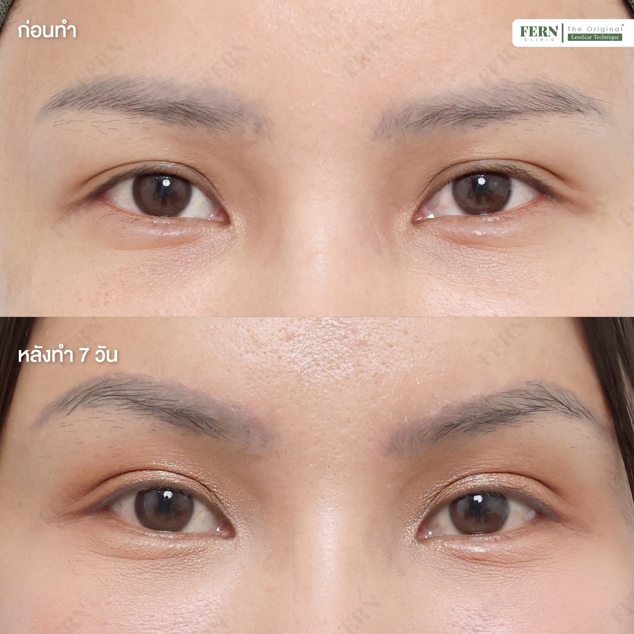 LINE_ALBUM_เคสรีวิว DBL_250927_10