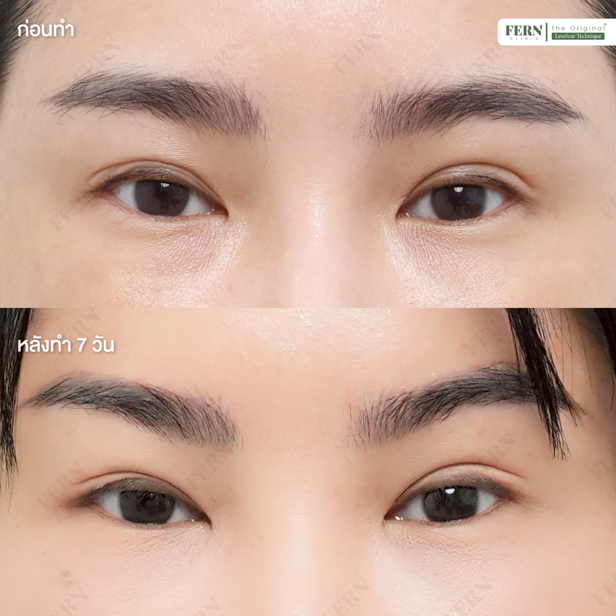 LINE_ALBUM_เคสรีวิว DBL_250927_18