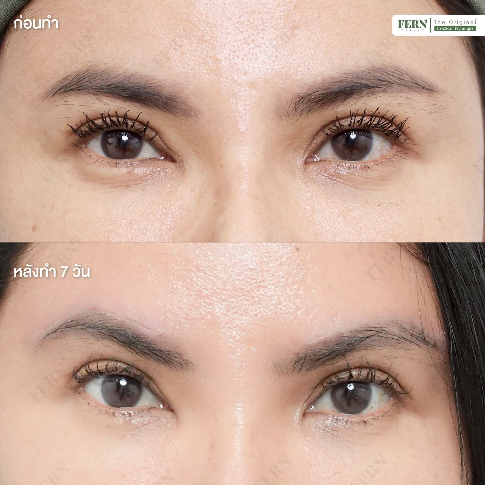 LINE_ALBUM_เคสรีวิว DBL_250927_6