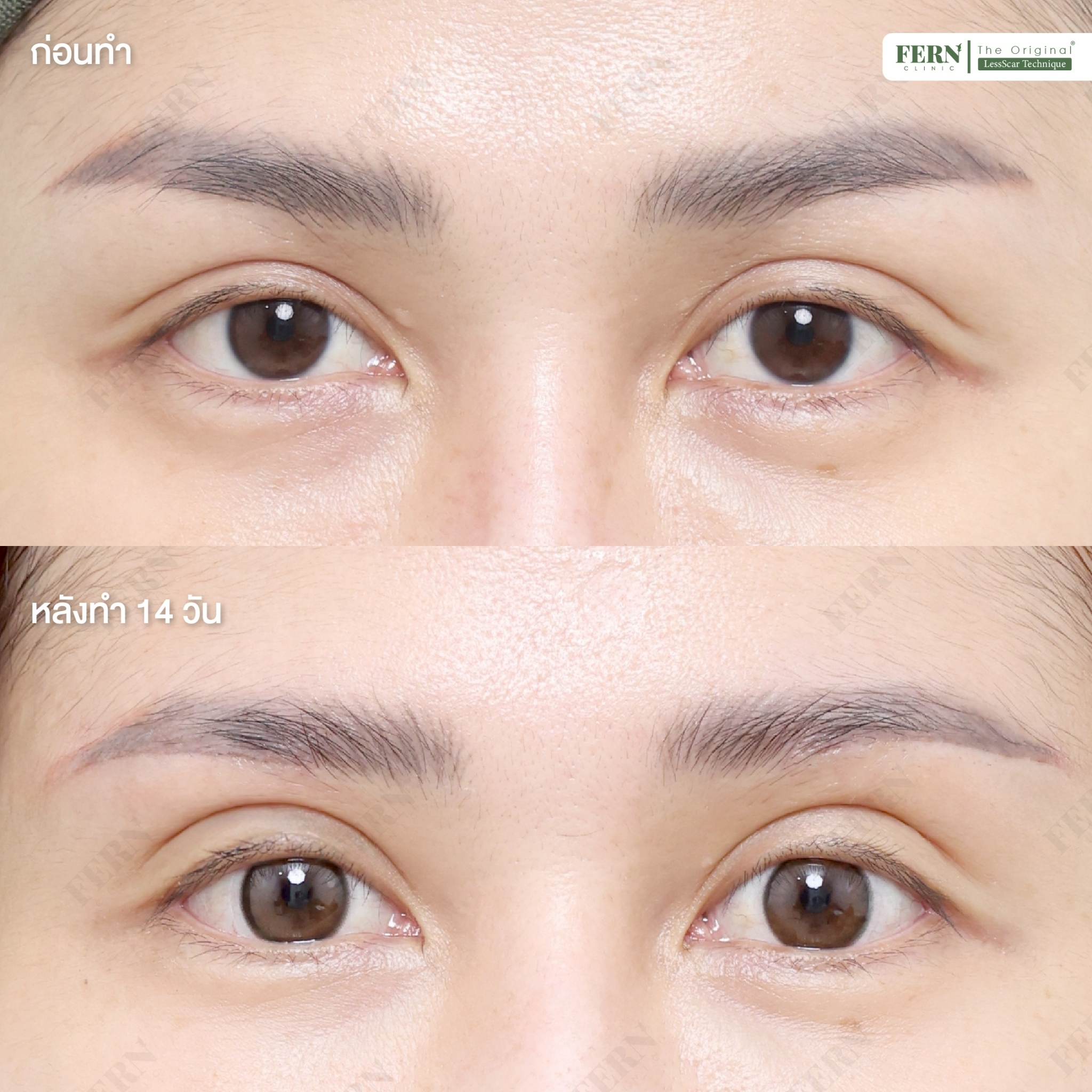 LINE_ALBUM_เคสรีวิว SBL_250926_1