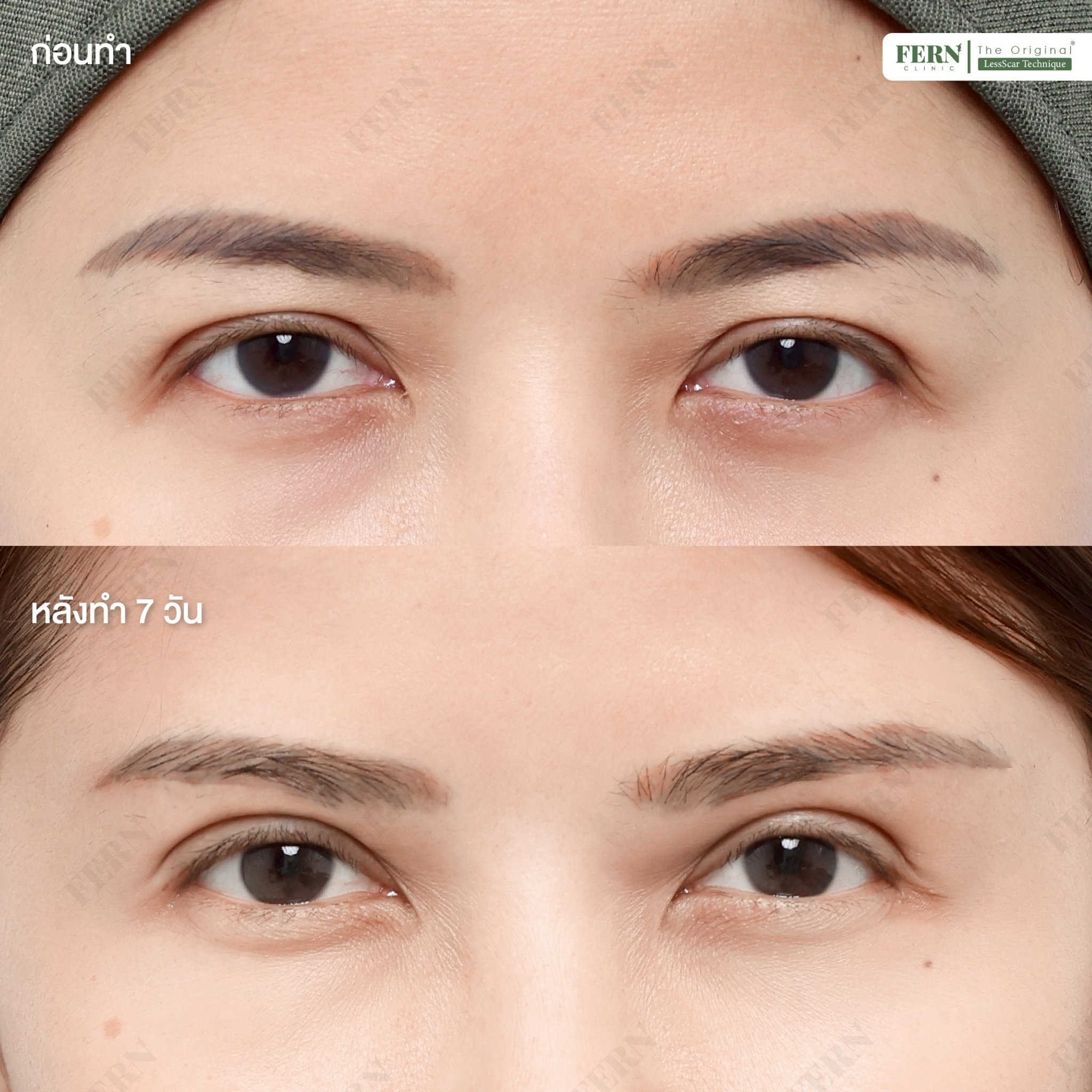 LINE_ALBUM_เคสรีวิว SBL_250926_2