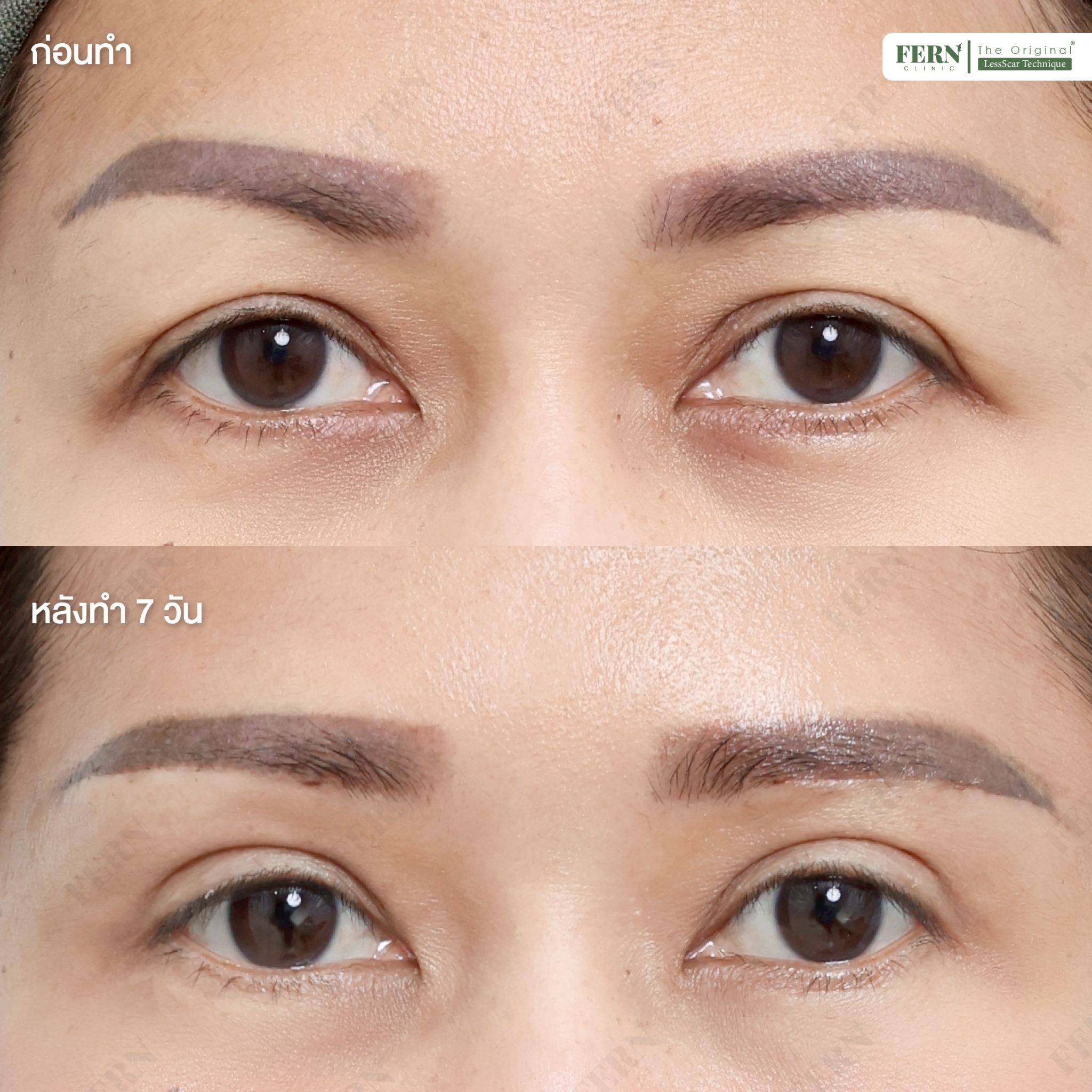 LINE_ALBUM_เคสรีวิว SBL_250926_3