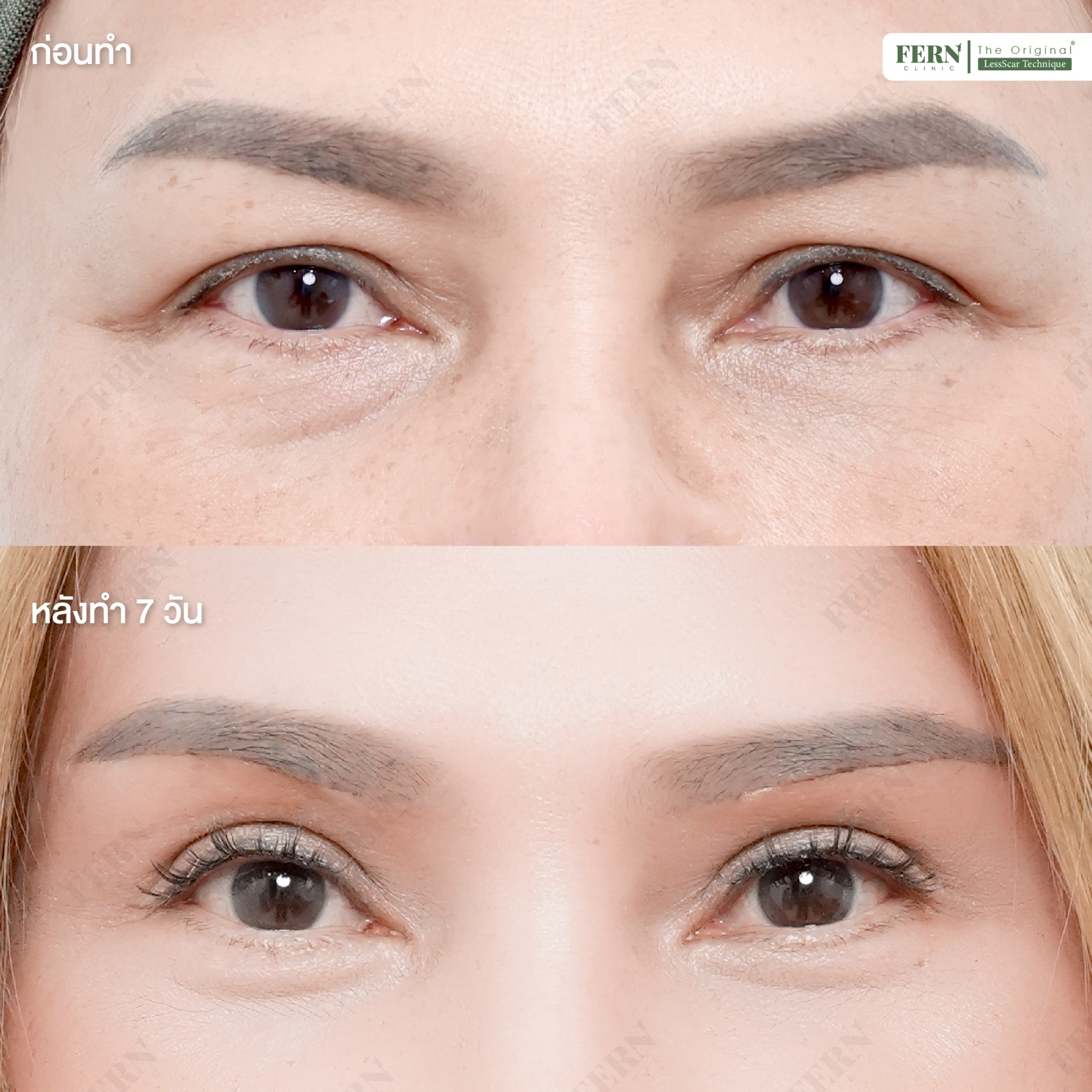 LINE_ALBUM_เคสรีวิว SBL_250926_4