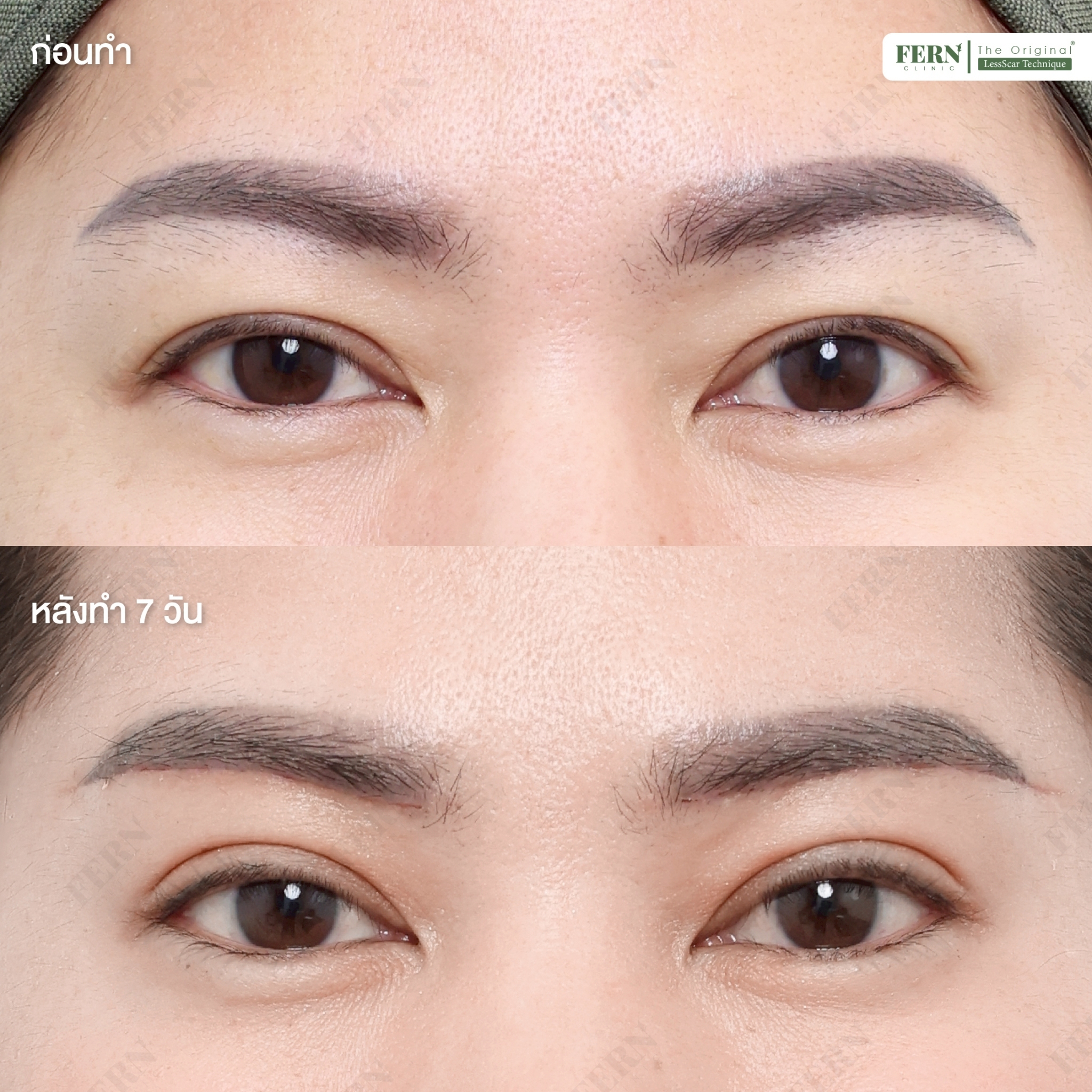 LINE_ALBUM_เคสรีวิว SBL_250926_5