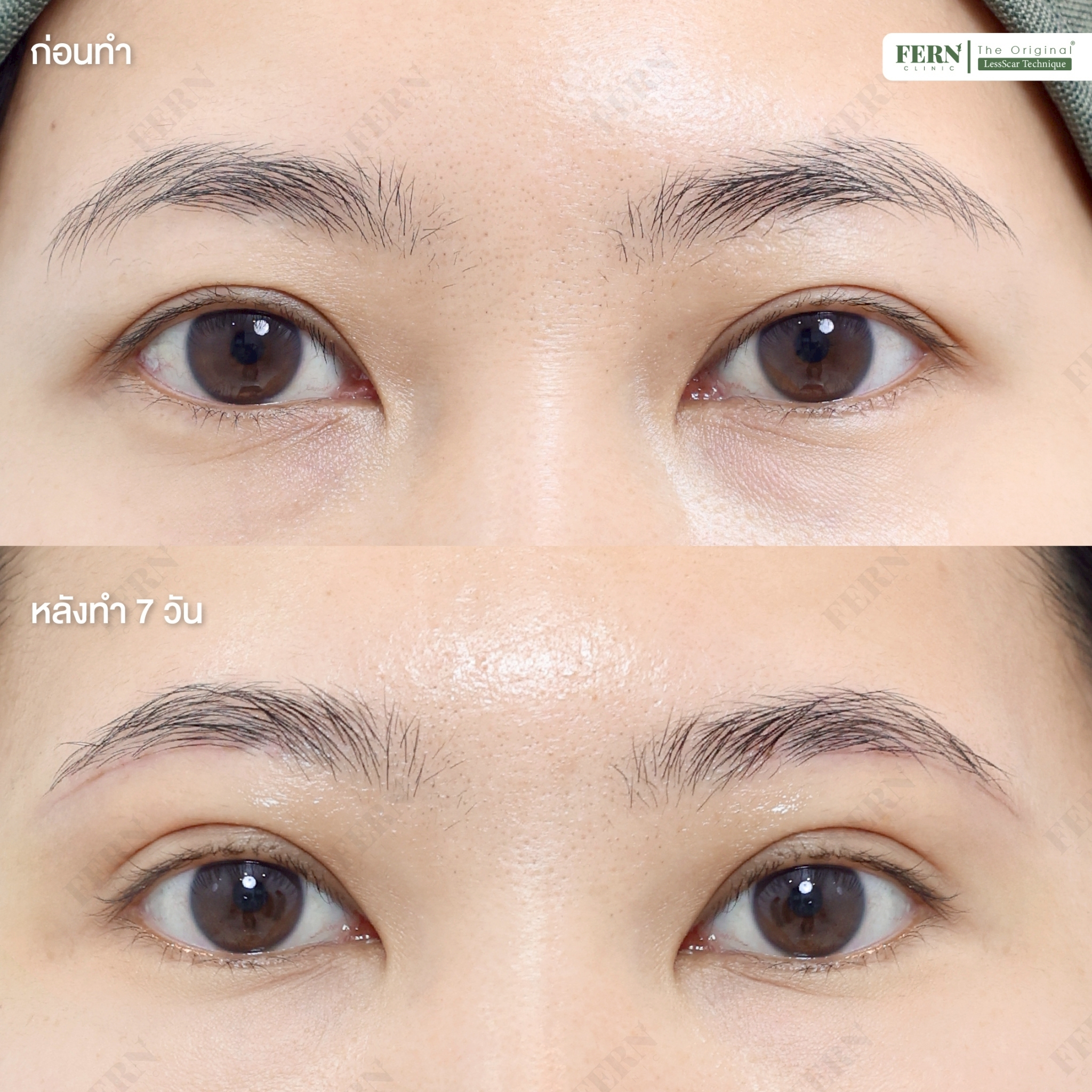 LINE_ALBUM_เคสรีวิว SBL_250926_9