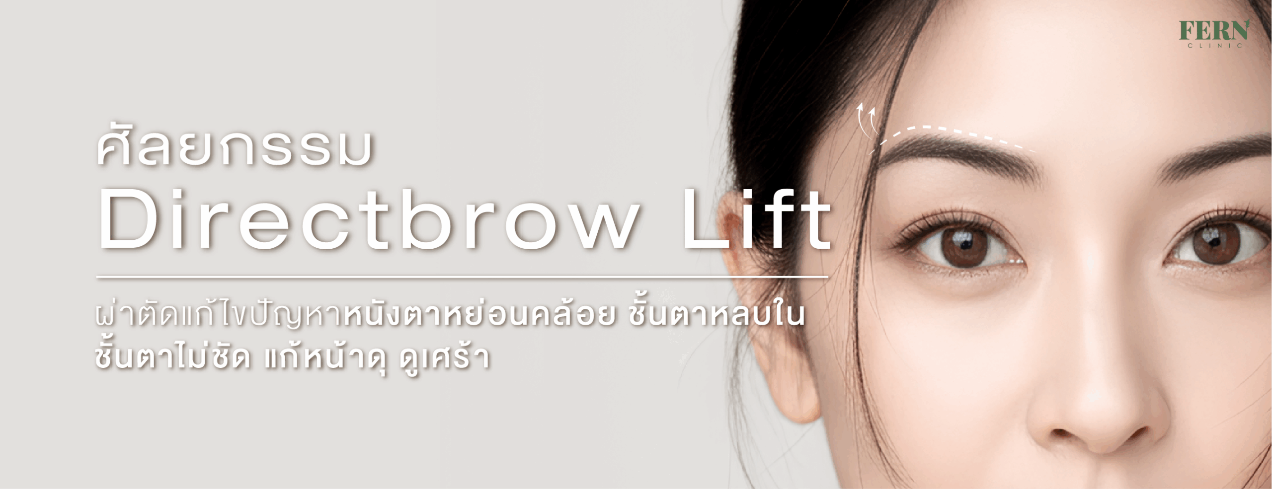 ศัลยกรรม Directbrow Lift ผ่าตัดแก้ไขปัญหาหนังตาหย่อนคล้อย ชั้นตาหลบใน ชั้นตาไม่ชัด แก้หน้าดุ ดูเศร้า  