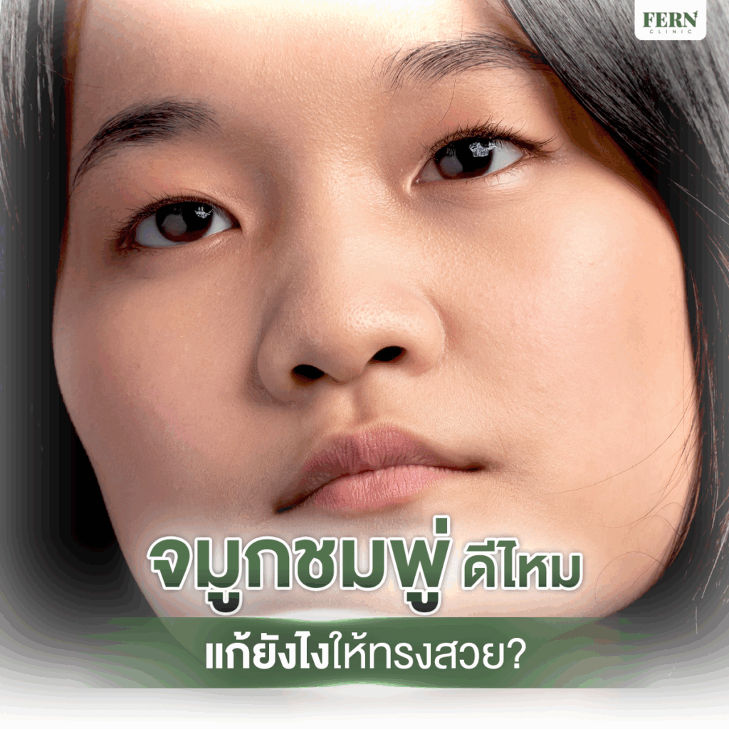 จมูกชมพู่ ดีไหม แก้ยังไงให้ทรงสวย
